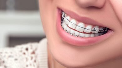 Why Orthodontic Treatment Is Important for Your Oral Health